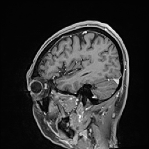 Click on the Serie image to view the images of VILLANUEVA, WILLIAM A.